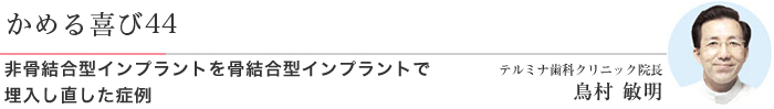 かめる喜び44 非骨結合型インプラントを骨結合型インプラントで埋入し直した症例 テルミナ歯科クリニック院長 鳥村 敏明