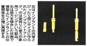 左はインプラントの内面とぴったり同じサイズに作られたインプラントアナログ。中は型採りに使う印象用コーピングという部品。右は両方を結合した状態で模型上にインプラントの位置関係を正確に再現する。
