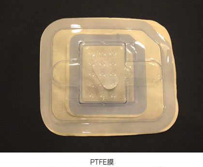 PTFE膜