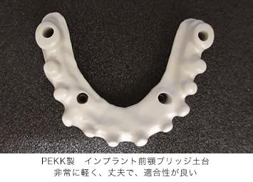 PEKK製　インプラント前顎ブリッジ土台：非常に軽く、丈夫で、適合性が良い