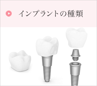 インプラントの種類